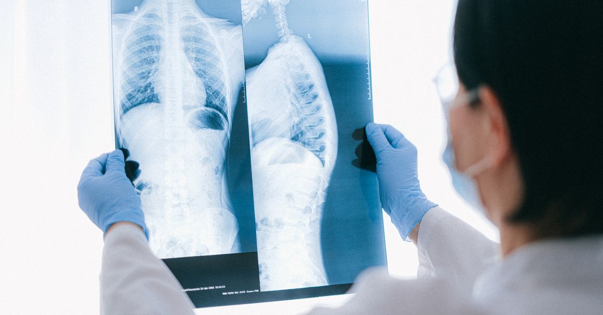 Why Prospective Trials Matter